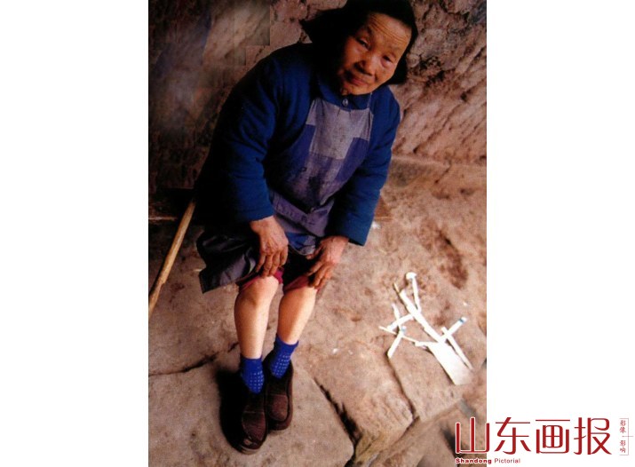 69岁、身高83公分的陈光菊老人双腿经常无故疼痛，但找不出什么原因