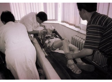 紧急抢救被解救的小女孩