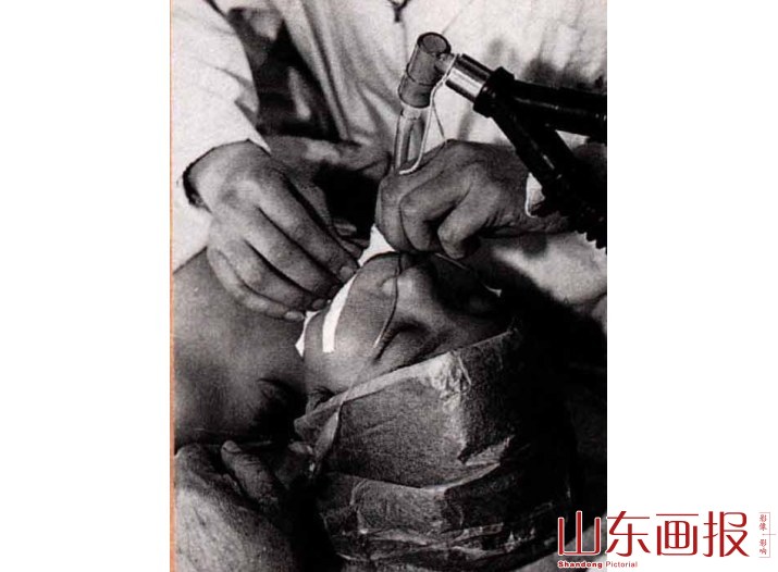 麻醉中的小守英