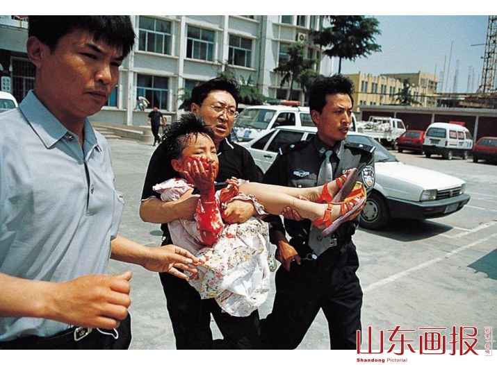 被救出的孩子已被扎伤多处