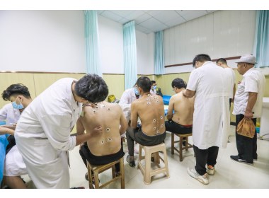 山东滕州：“冬病夏治”入伏时